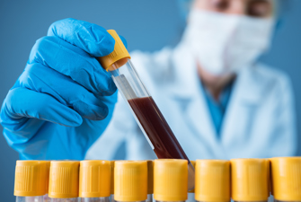 Doctor testing blood